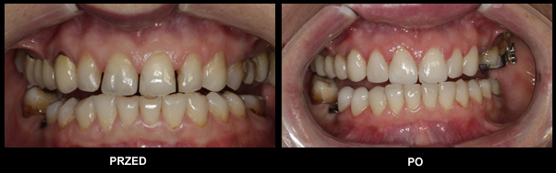 COSMETIC DENTISTRY